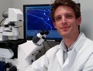 UBC study raises the standard for measuring nerve cell death